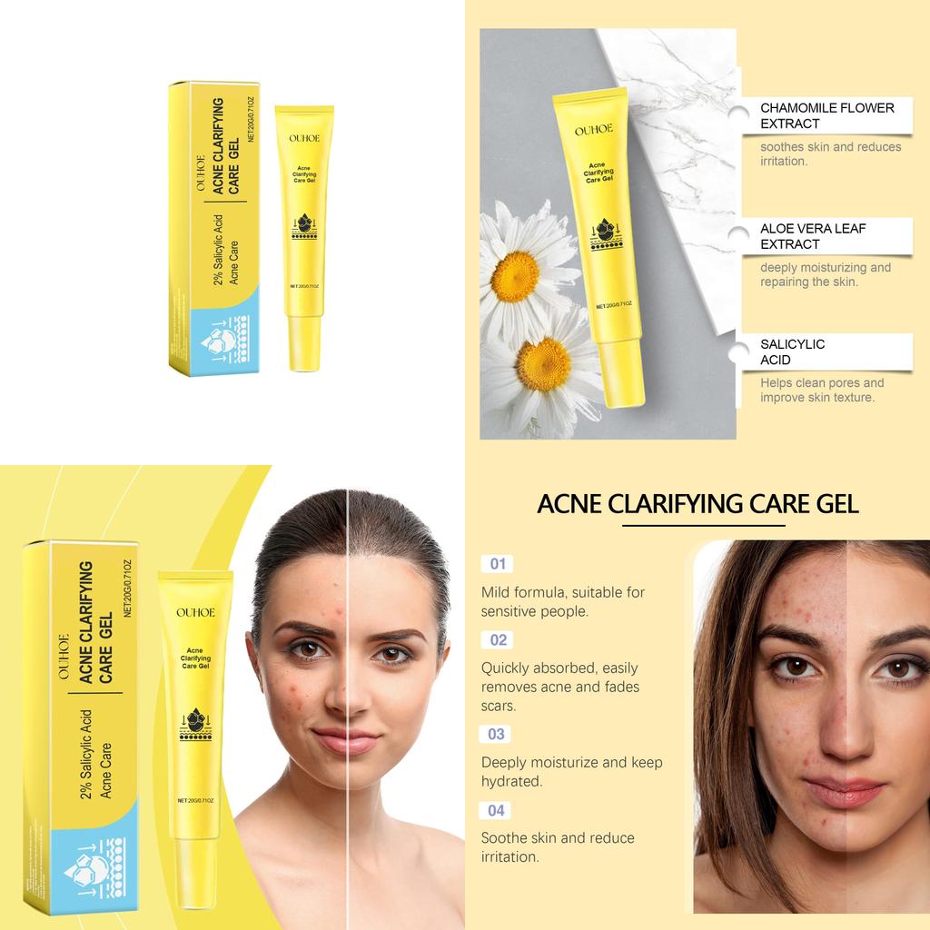 Ouhoe Acne Gel For Deep Cleansing And Brightening Skin With Pore Minimizing Formula 20g