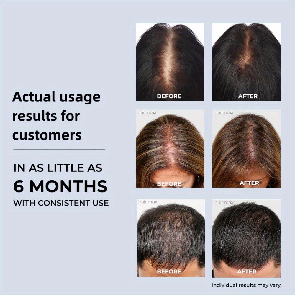 Red Light Laser Anti-Hair Loss Hair Growth Cap with Oil Control and Nourishing Care