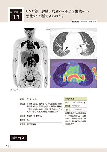 Diagnostic Imaging Dojo Updated Edition <Chest Edition>