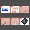 7pc/9pcs Blackhead Remover Tool Acne Remover Stainless Steel Acne Needle Set Facial Skin Pore Cleaner Skincare Cleaning Tool