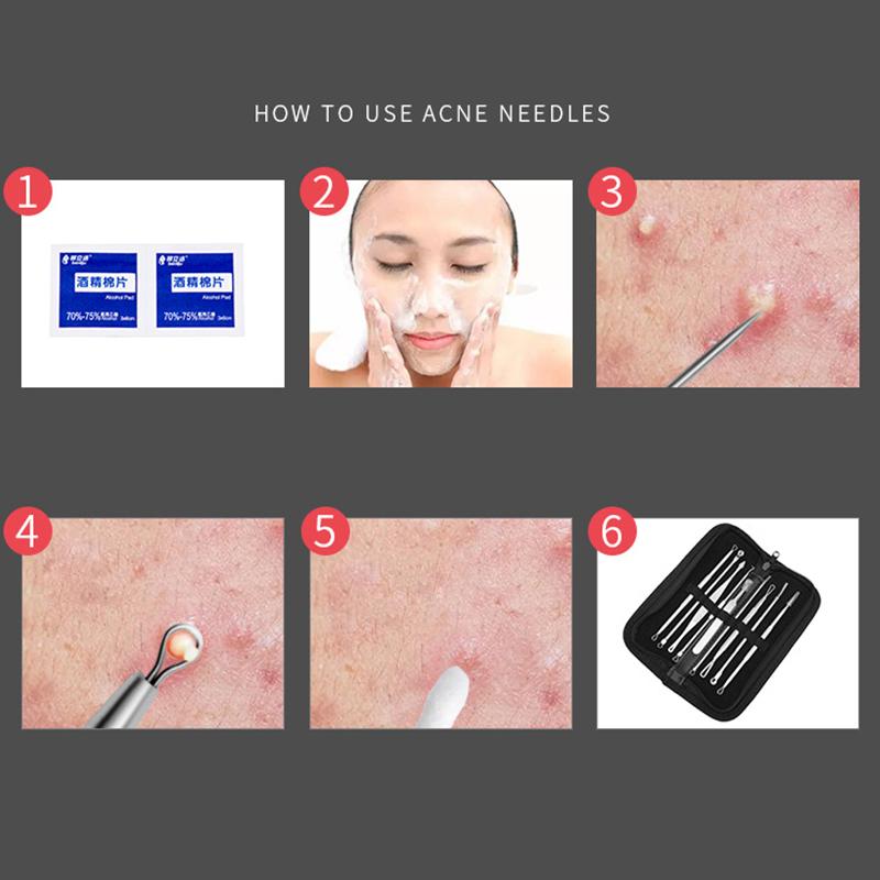 7pc/9pcs Blackhead Remover Tool Acne Remover Stainless Steel Acne Needle Set Facial Skin Pore Cleaner Skincare Cleaning Tool