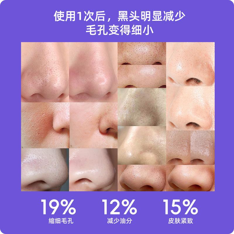 Visual Electric Blackhead Absorber High Suction Pore Cleaner Blackhead Magnifying Glass Visual Blackhead Absorber