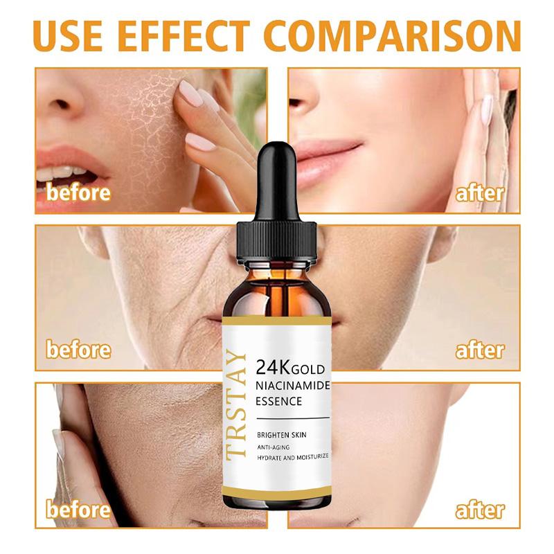 5G/15G/30G/50G/TRSTAY Moisturizing Cream, Vitamin C Brightening Face Cream, Brightening Skin And Lightening Spots