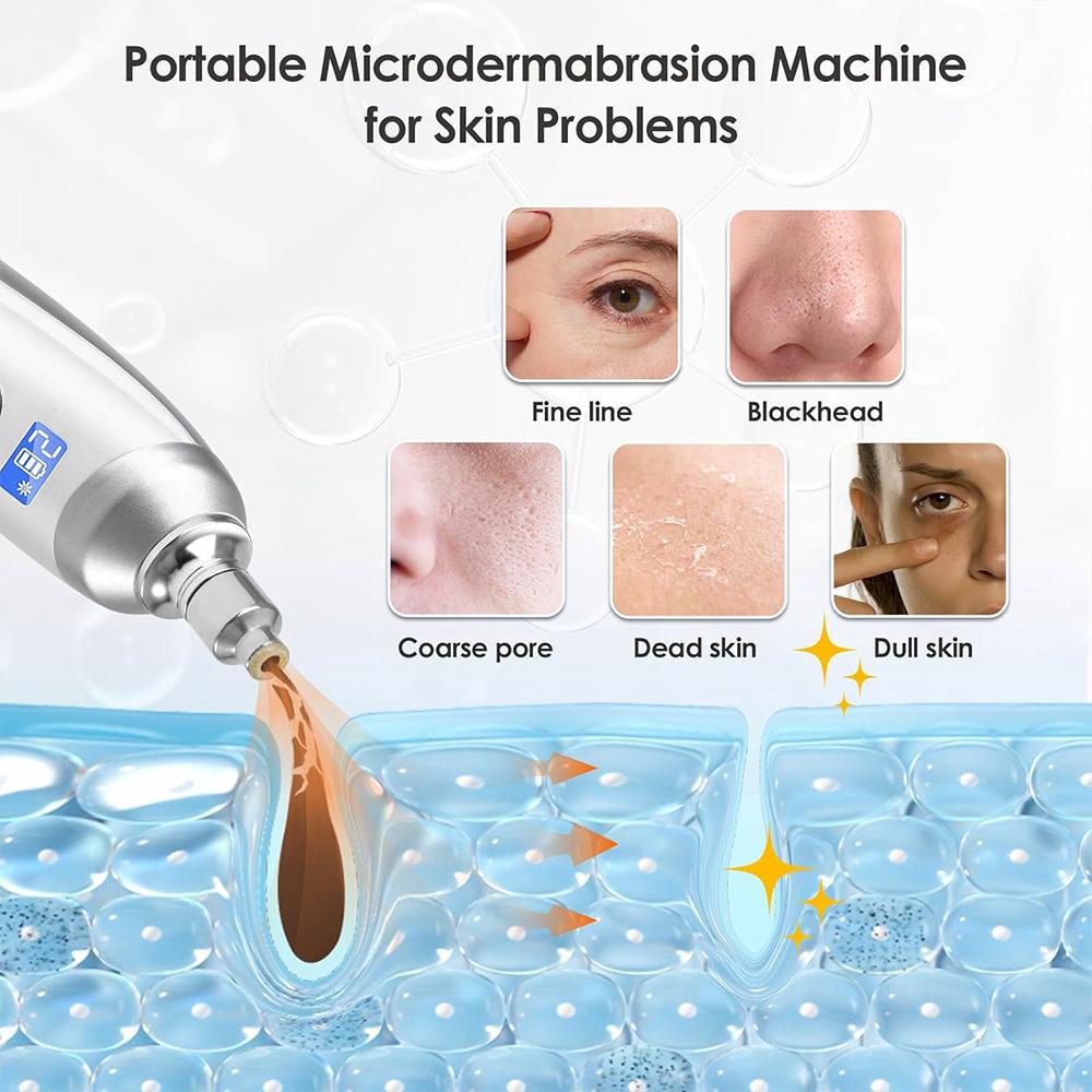Suction Blackheads God Electric Blackheads Instrument Go Blackheads Face Pore Beauty Face Deep Cleaning Skin Care