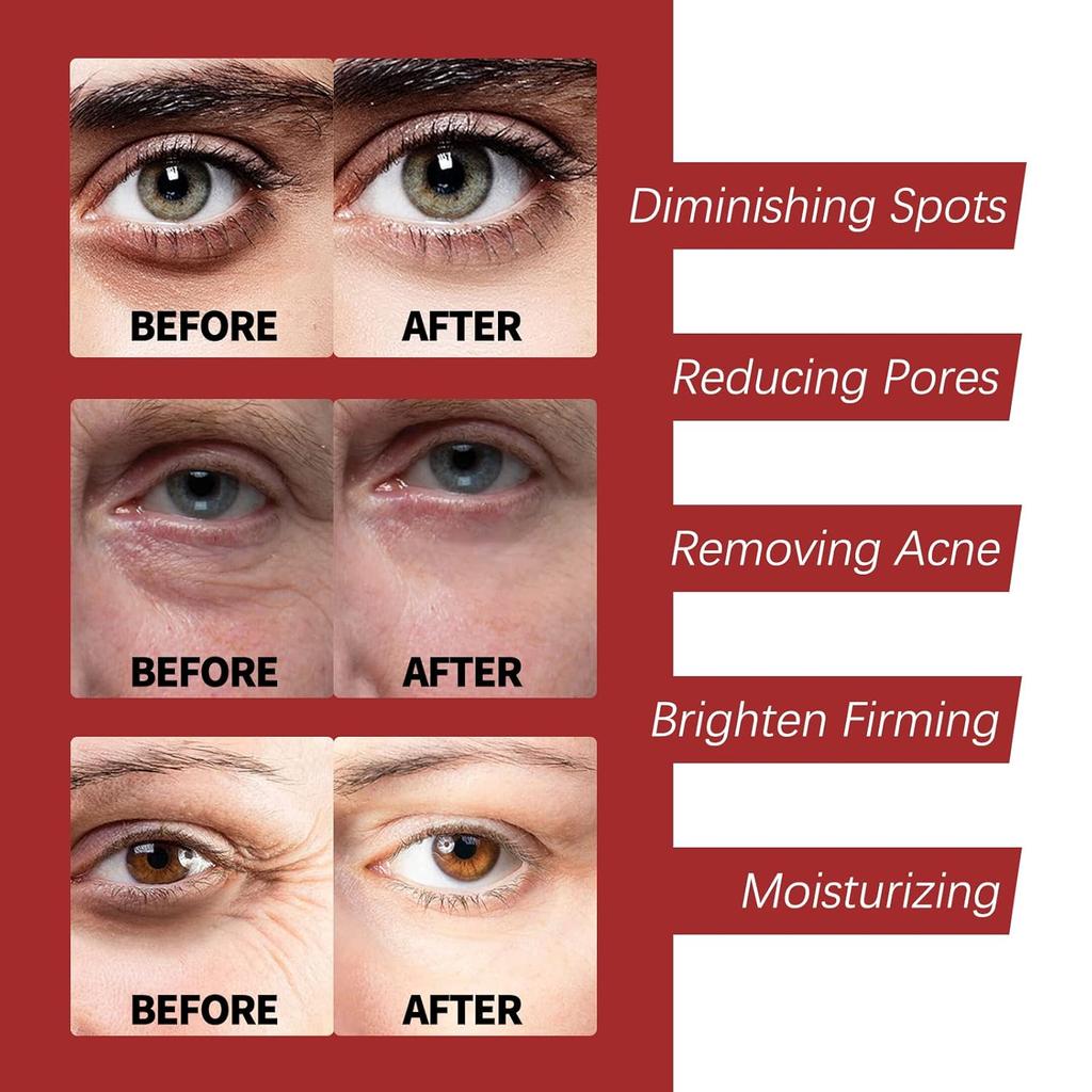 OUHOE Retinol Complex Cream: Unlock Your Skin’s Youthful Glow.