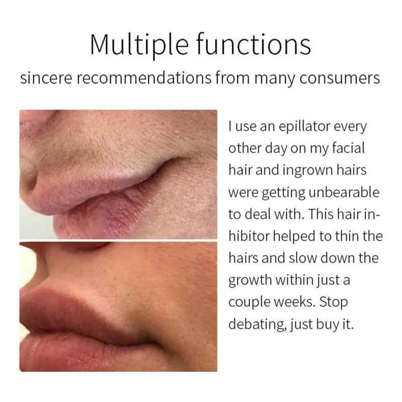 Inhibitor de creștere a părului Loțiune de corp pentru suprimarea părului Îndepărtare eficientă fără durere Hidratare