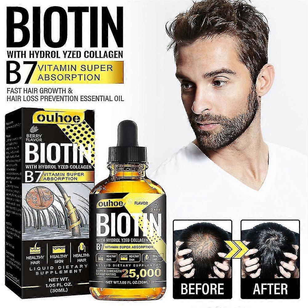 3x Vitamin B7 Hair Essential Oil Treatment Preventing Loss Restorer Essential Oil Biotin Hair Growth Oil 30ml