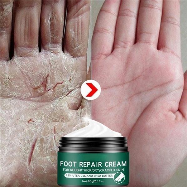 La più recente crema idratante riparatrice per la pelle delle mani e dei piedi anti-screpolature per piedi screpolati, secchi e screpolati, crema per i piedi riparatrice del tallone