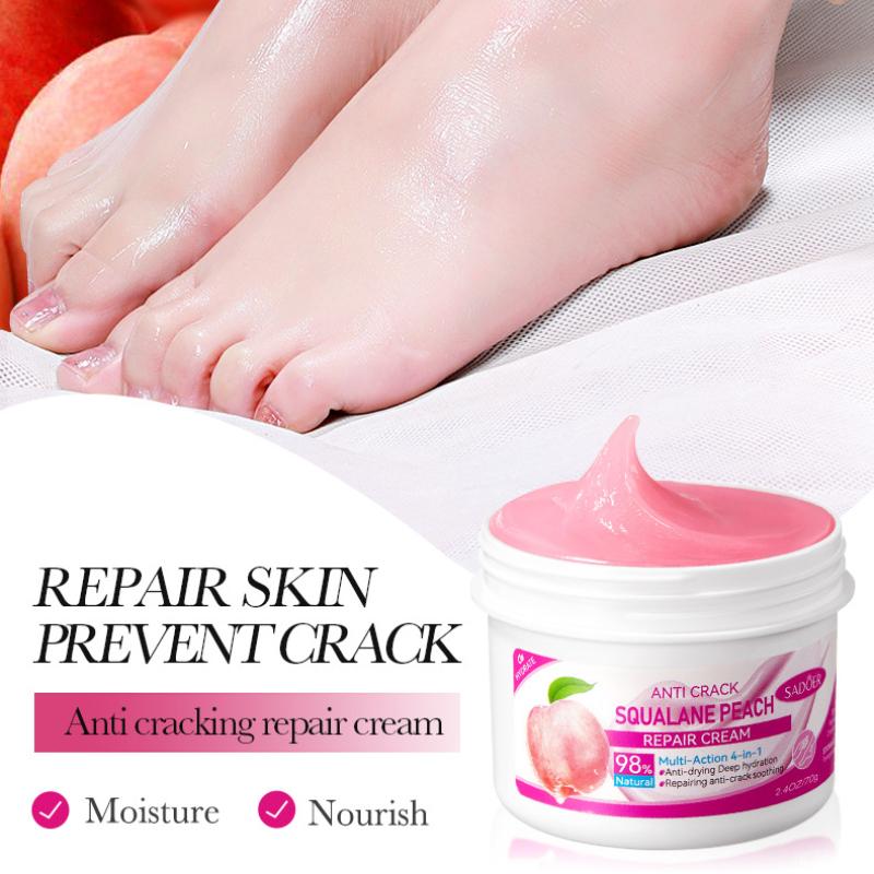 Squalan Feuchtigkeitscreme 70g SADOER Feuchtigkeitsspendende Hydratisierende Horn Hand- und Fußfeuchtigkeitscreme