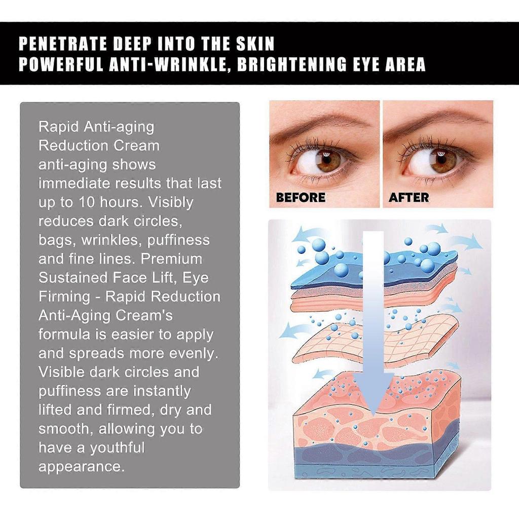 Hoygi Aloe Vera Eye Gel Patches - Reduces Fine Lines, Eye Bags, And Dark Circles, Firms The Eye Area, Anti-Wrinkle And Moisturizing Eye Patches