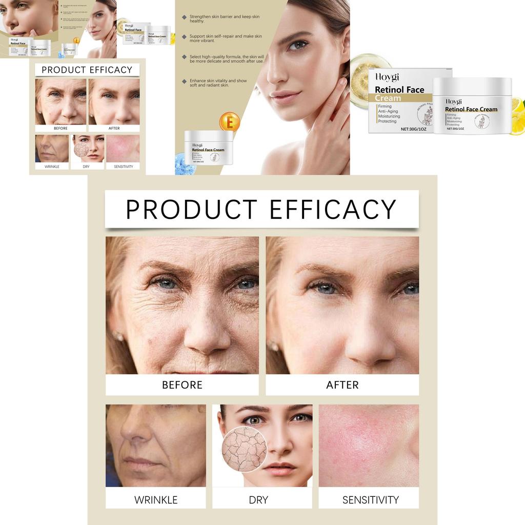 Hoygi Retinol Moisturizing Cream With Brightening And Hydrating Collagen Formula