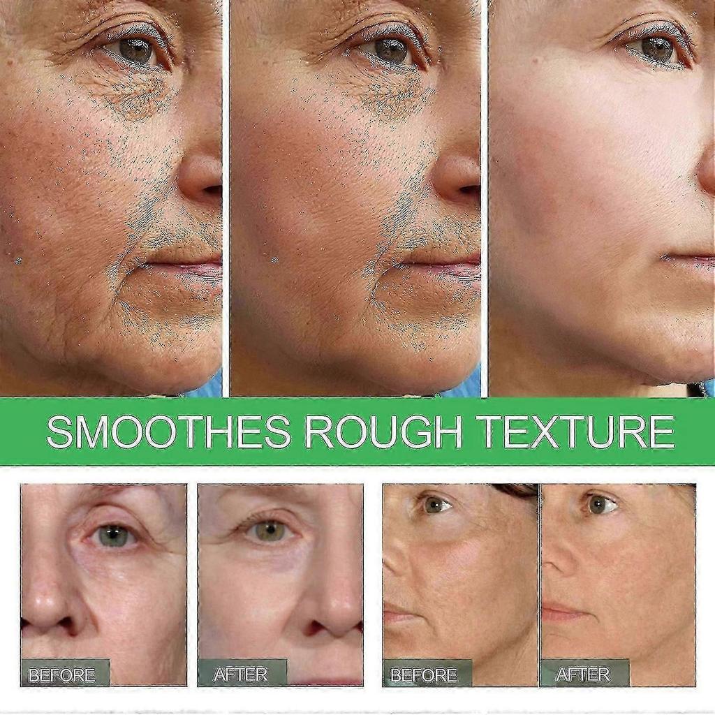 - 2pack Deep Anti-wrinkle And Anti-aging Serum