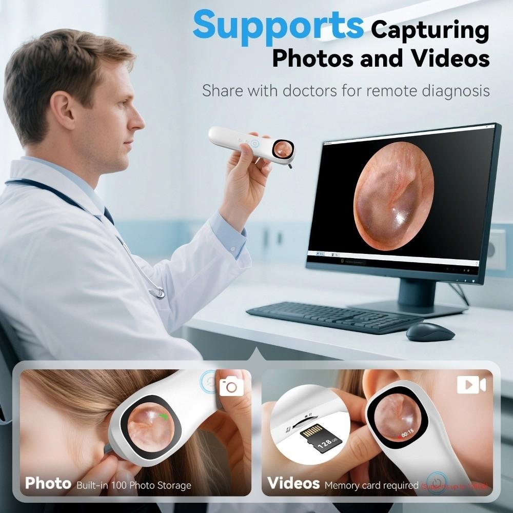 1080P HD Ear Camera 1.21 Inch IPS Screen Visual Ear Care Durable Smart Detector  Ear Care