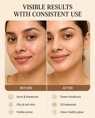 FOYU Skincare's Anti-Acne "CLEAR IT" Face Wash, with 2% Salicylic Acid and Niacinamide, Removes Pimples & Inflammation, Paraben and Sulphate Free,