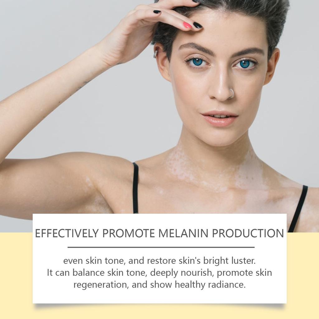Promote Metabolism, Reduce Inflammation, And Help Reduce The Area Of White Spots.help Reduce Pigment In Areas Of White Spots