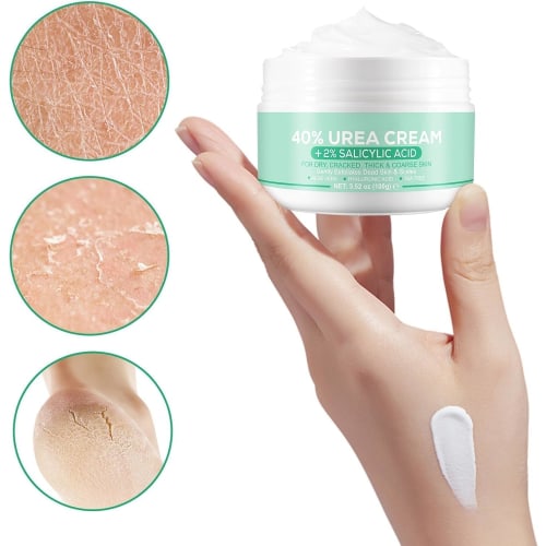 Urea Cream, Hand and Foot Hydration, 40% Urea Cream for Dry, Cracked Feet, Heels, Knees, Elbows, and Hands, Moisturizing, Corn Removal, and Calluses,