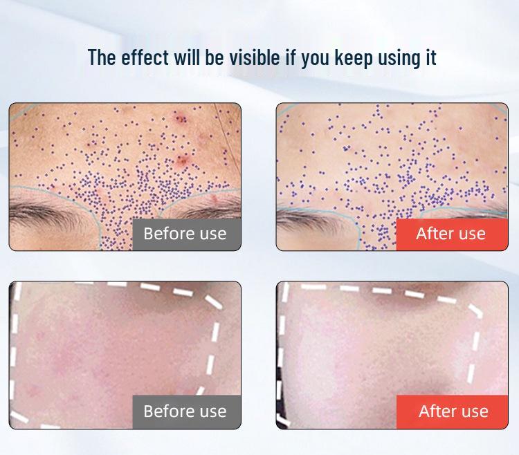 8-Color Silicone LED Light Mask: Red & Blue Photon Beauty Rejuvenation Facial Device