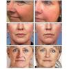 Retinol Wrinkle Removal Face Cream Firming Lift Anti-aging Eye Fade Fine Lines B