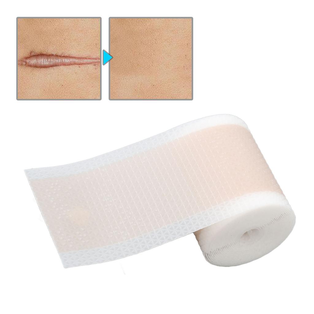 Silicone Scar Tape Roll Waterproof Self Adhesive Cuttable Gentle Scar Tape Roll for Full Body 4 X 150cm