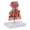 Human Pathologies of Rectum Model Human Rectum Model Human Anatomical Model Easy To Use Medicals Teaching Aid