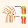 1 Pair Self Heating Knee Pads Wormwood Cold Resistant Warm Knee Support Belts Knee Pads for