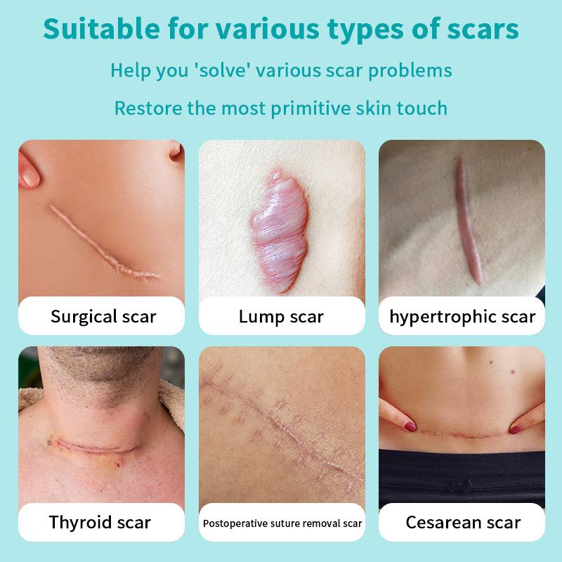 1 Pcs Silicone Scar Sheets Self-Adhesive Scar Cover Tape Reusable And Effective Skin Care Strips Highly Absorbent For Wound Care