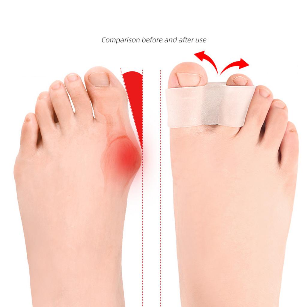 Adjustable Silicone Toe Separators For Bunions 2 Pack Flexible Design For Various Shoe Sizes Support All Day Wear