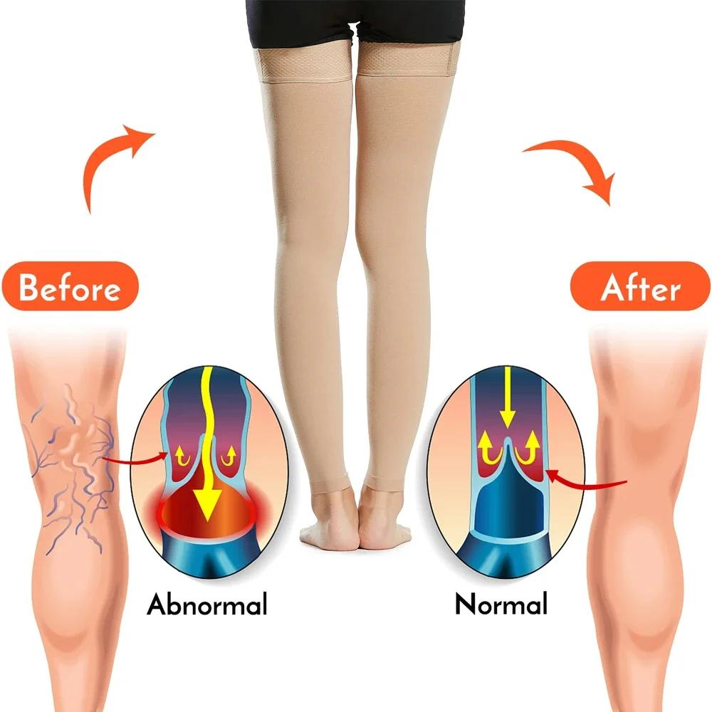 1 Paar Oberschenkelhohe Kompressionsstrümpfe für Damen & Herren, Offene Zehen, Fester Halt 30-40 mmHg Kompressionsstrümpfe bei Krampfadern