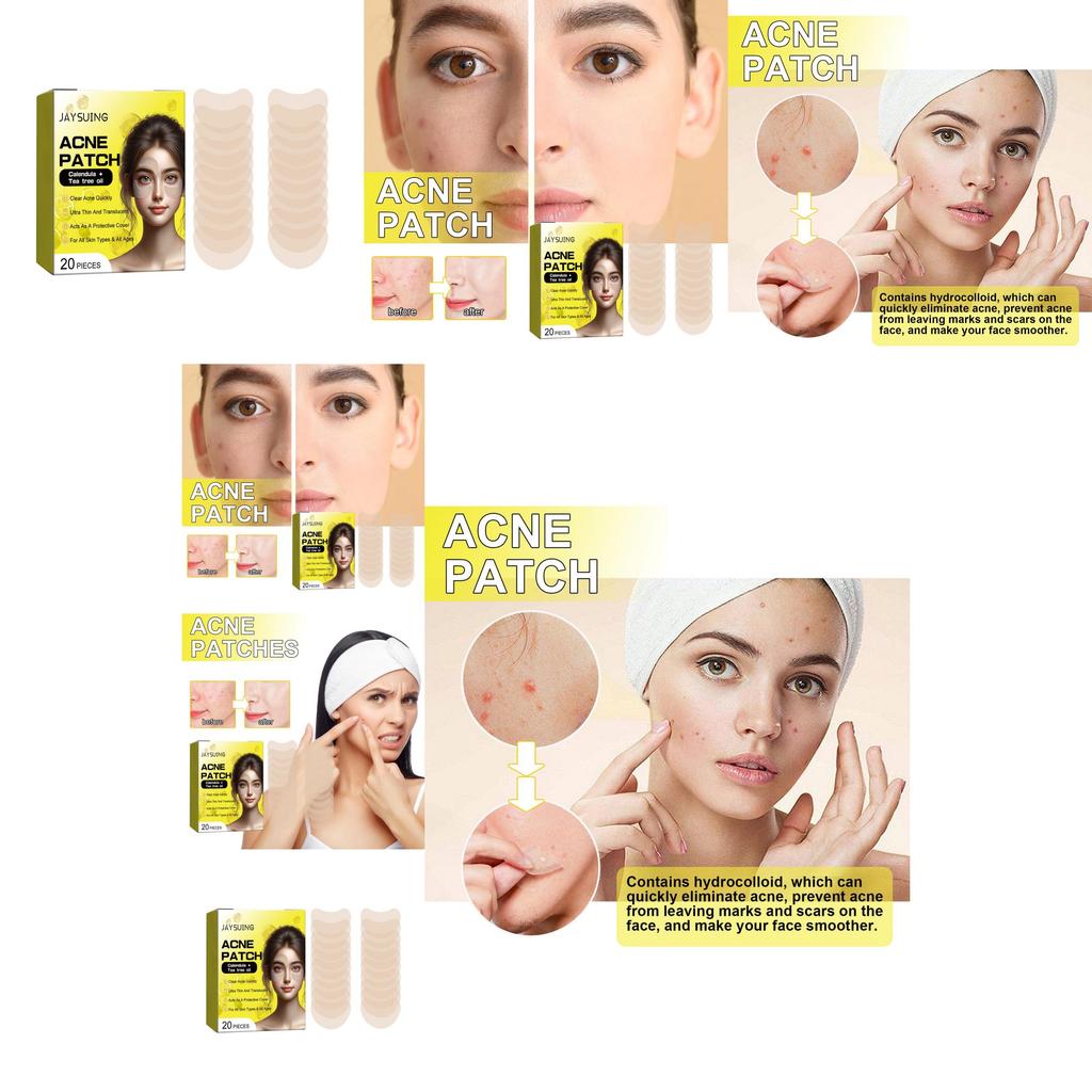 Jaysuing Acne Patches For Clear Skin 20pcs Effective Blackhead Removal Treatment