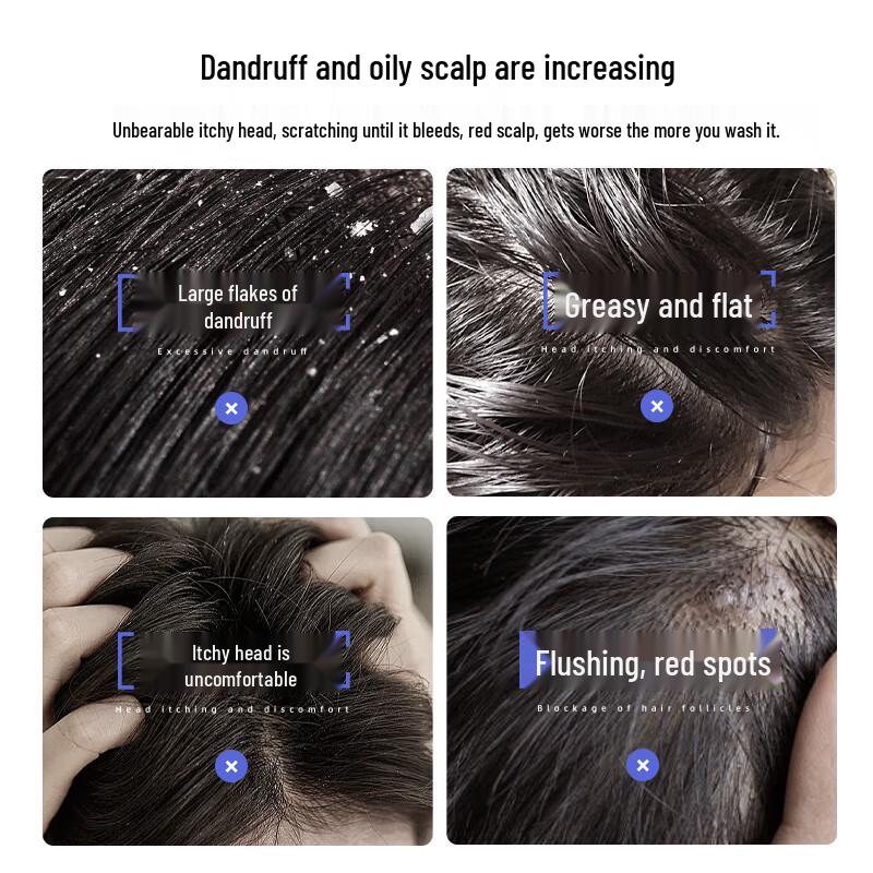 Cailiao Selenium Disulfide Anti-Dandruff Shampoo 420ml