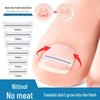 NiTi Alloy Bionic Toenail/Fingernail Corrector for Ingrown Nails