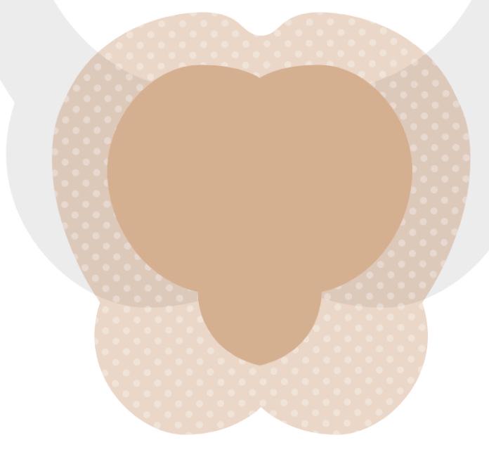 Silicone Gel Foam Dressing for Pressure Ulcer Care - Sterile Polyurethane Foam Patch