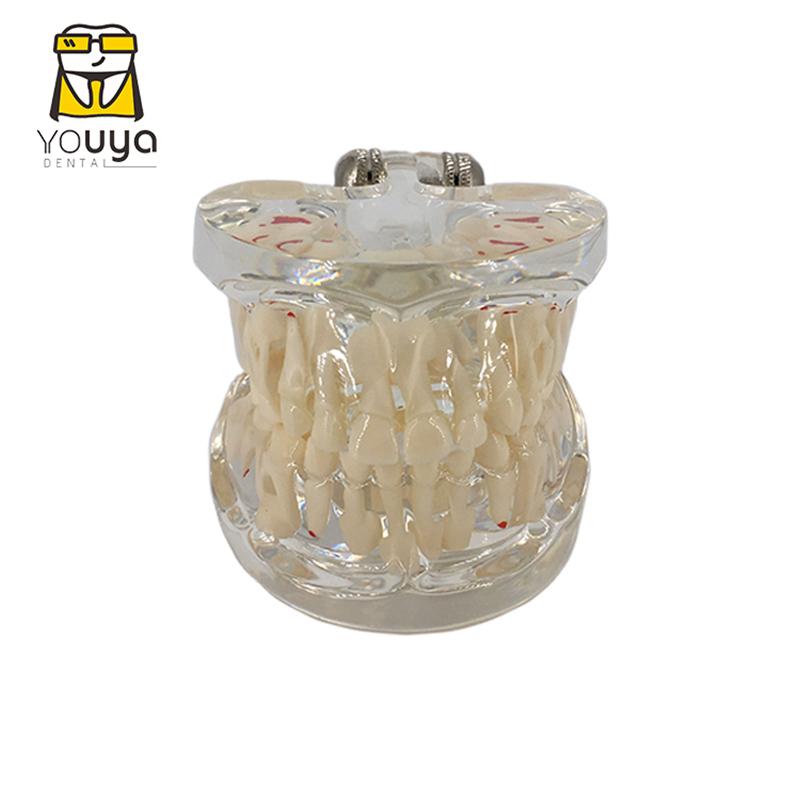 Dental Model For Children Deciduous Tooth Permanent Teeth Alternating Study Teathing Pediatric Dental Pathology Preventive Model