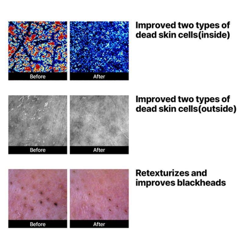 SOME BY MI *renewal* Lactosoy Mild Bubble Peeling Cleanser 180ml