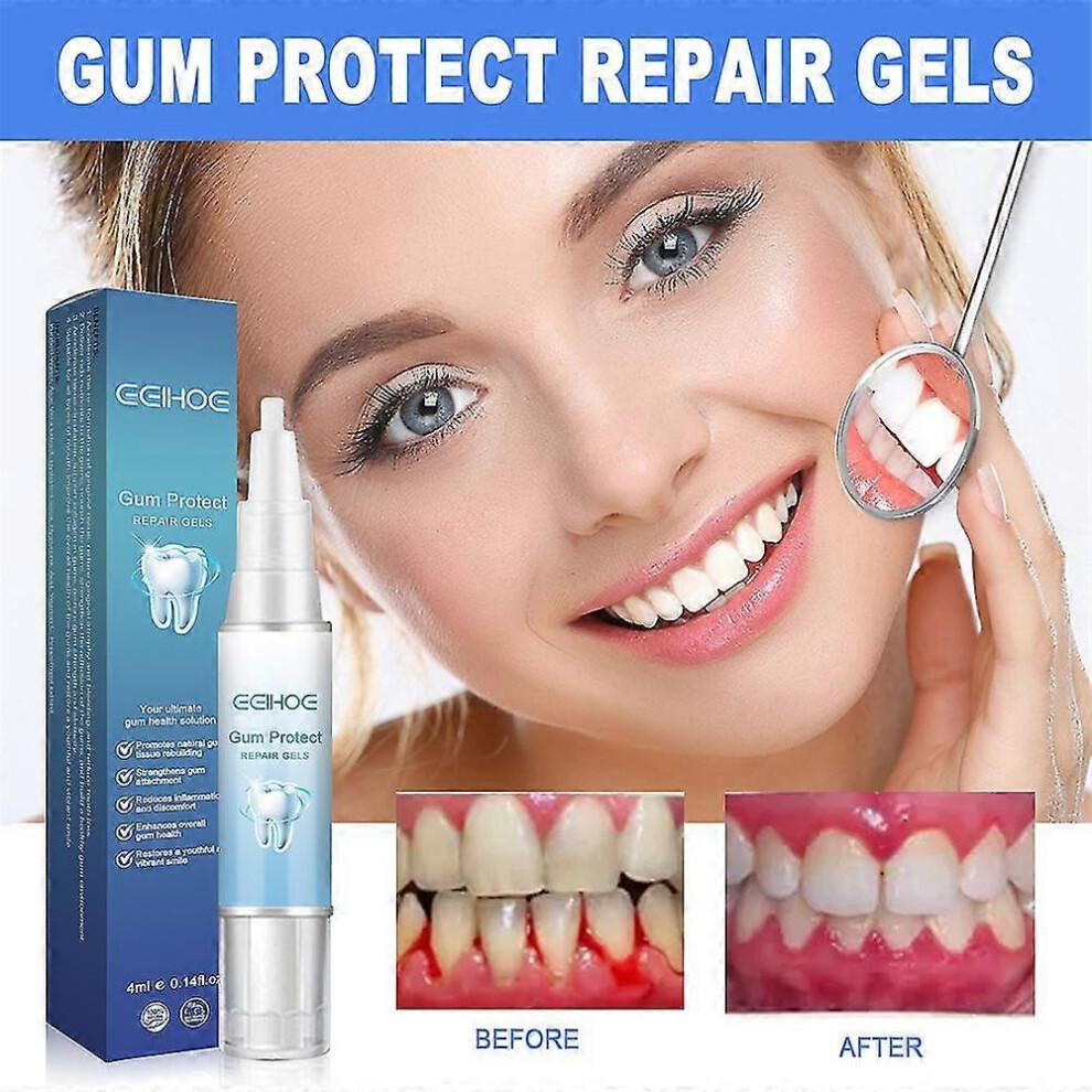 3pcs Gel de Reparo Gengival Fortalecedor Clareador Remove Inflamação, Mau Hálito, Manchas Gengivais, Proteção contra Retração Gengival Cuidado da Saúde Bucal