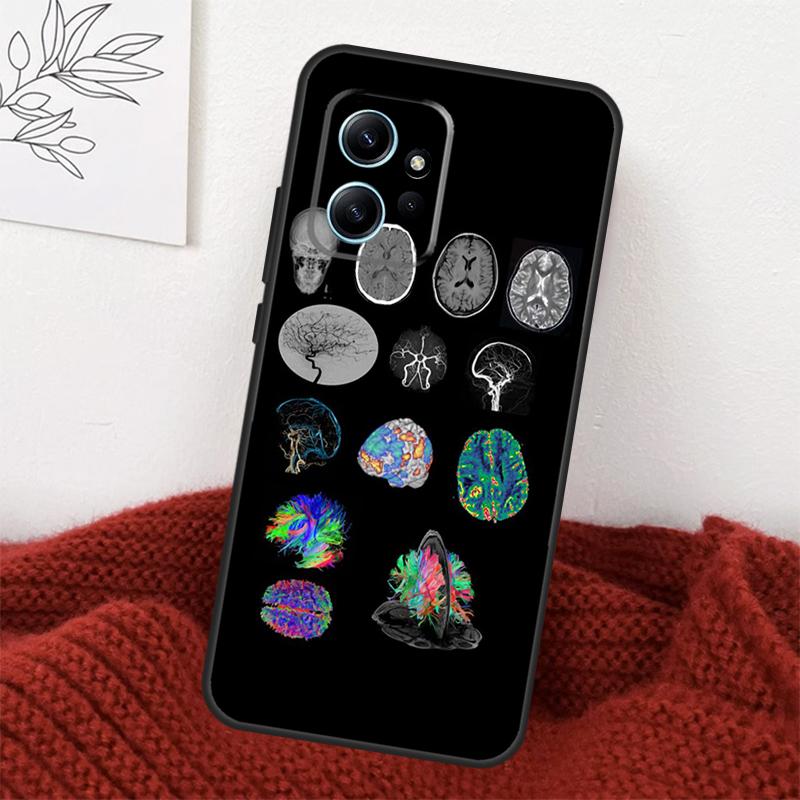 Medical Human Organs Brain Case For Xiaomi Redmi Note 13 9 10 11 12 14 15 Pro Plus Cover For Redmi 15 C 12C 13C 14C 10C