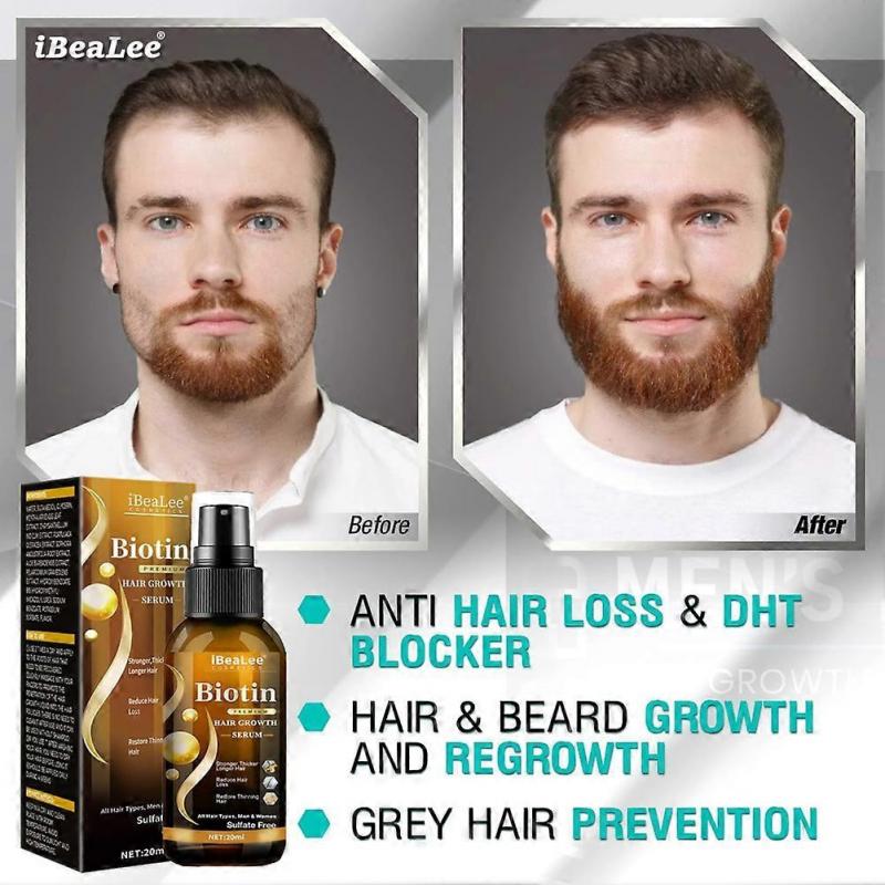 Biotin hair growth spray anti hair loss fast regeneration scalp treatment essence