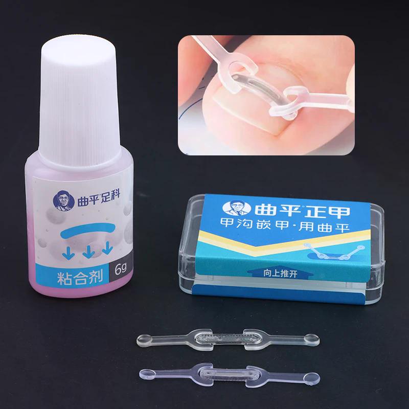 Nail Care Ingrown Toenail Correction Tool With Elastic Patch Sticker And Straightening Clip Brace - Pedicure Tool