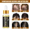 Fast Hair Growth Serum Hair Regrowth Essential Oil Anti Hair Loss Repair Damaged Scalp Women Men Anti Baldness Hair Growth Care
