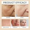 AMZ Facial Cream  Gentle Moisturizing Softening Deep Nourishing Brightening Hydrating Refreshing Non-Greasy Daily Skincare for All Skin Types 50g