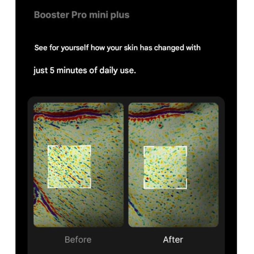 [Ive Jangwonyoung Pick] Medicube [AGE‑R] Booster Pro Mini Plus+