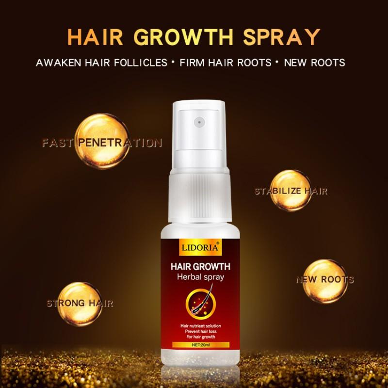 20ML Hair Growth Ginger Spray Oriental Oilss Hair Nutrition / Hair Loss Treatment Treatment Oil Hair Tonic Hair Care Loss