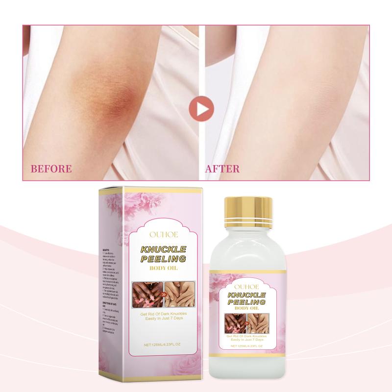Brightening Body Serum Deep Hydrating Concentrate For Knees Elbows And Dry Areas, Moisturizing Skin Care Formula For Even Tone