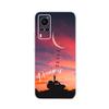 Transparent Tpu Coque Cover For Vivo X60 Pro Case High Quality Luxury Silicone Soft Phone Case For Vivo X60 4G 5G X60T X 60 Case
