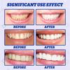 5D Whitening Teeth Stickers Gel Whitening Strips Stain Removal Oral Hygiene Care Strip Dental Bleaching Clean Oral Hygiene Teeth