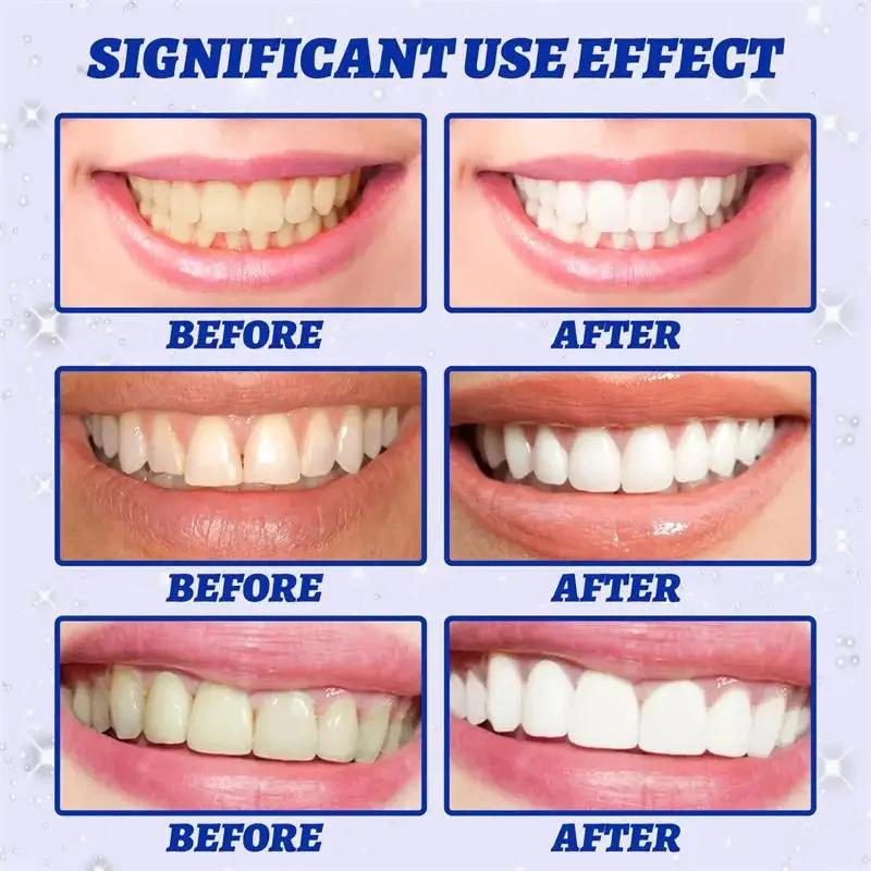 5D Whitening Teeth Stickers Gel Whitening Strips Stain Removal Oral Hygiene Care Strip Dental Bleaching Clean Oral Hygiene Teeth