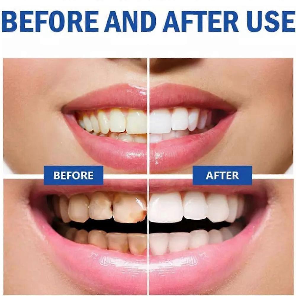 Cophksu Sp10 Probiotic Toothpaste,Sp10 Ultra Whitening Toothpaste,Pasta Dental