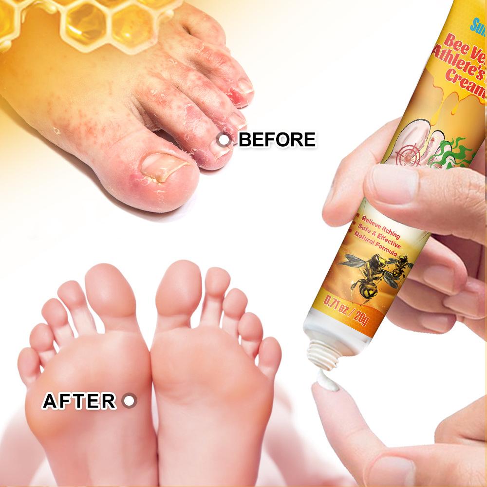 Sumifun 20/40/100 ML Foot Odor Care Cream Bee Relieves Redness and Swelling Soothing Itchy Feet Effectively Summer Home Essential