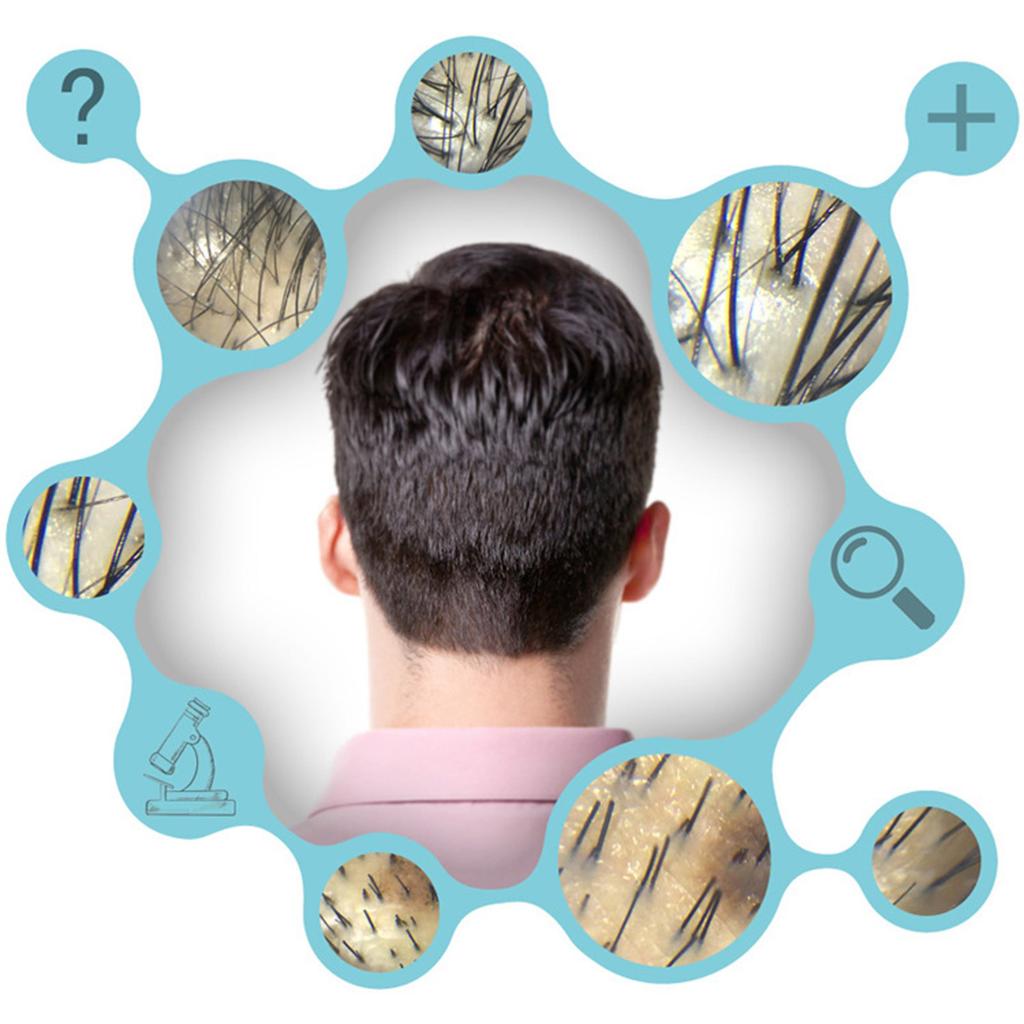 Portable 30X Cellphone Microscope with LED Light and Macro Lens for Enhances Optical Zoom Mobile Phone Camera Lens