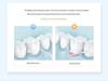 Portable Electric Water Flosser for Effective Oral Cleaning and Tartar Removal